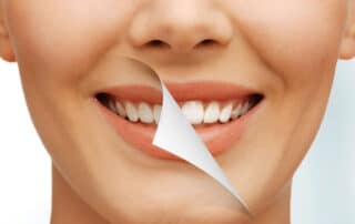 teeth cleaning cost