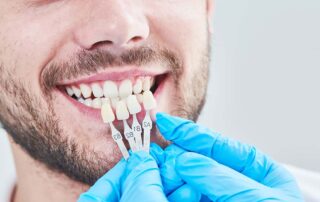 Man with Veneers