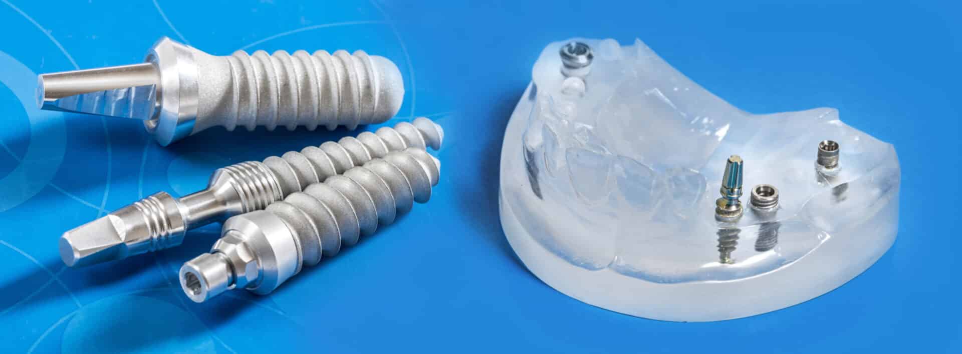 Titanium Dental Implants