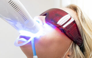 Teeth Whitening