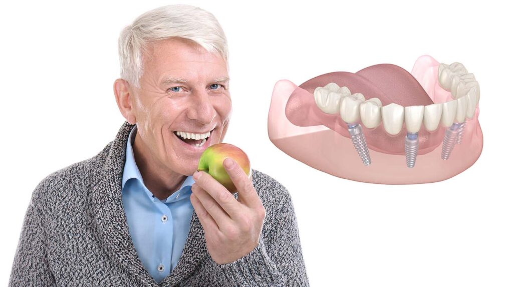 tooth replacement los angeles