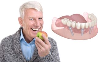 tooth replacement los angeles