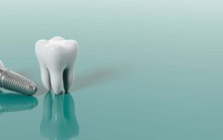 How much to pay for a Tooth Implant