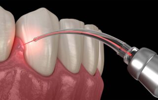 Gum Disease Treatment Guide