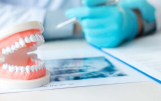 denture los angeles ca