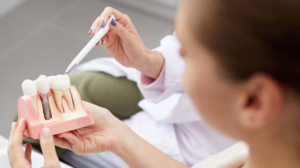 Dental Implants Pros and Cons