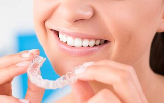 Invisalign Cost Los Angeles, CA