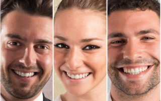 smile makeover