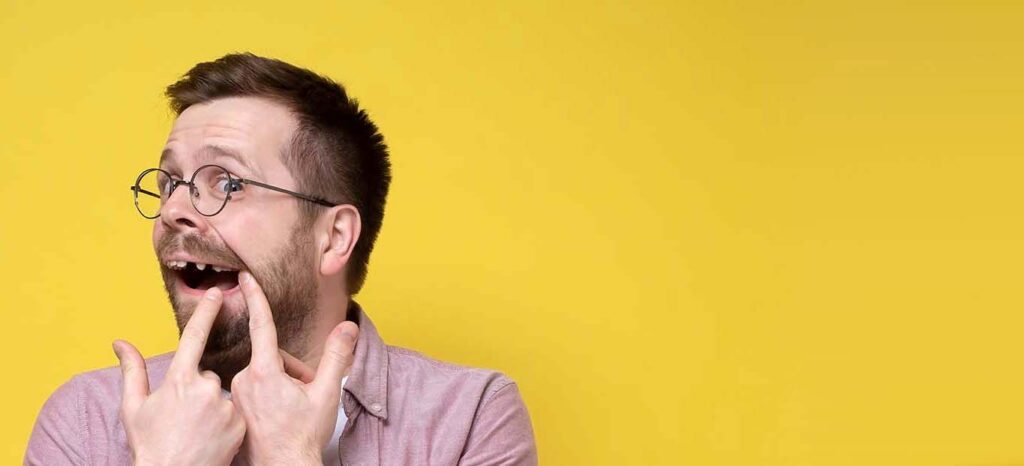 man with missing teeth