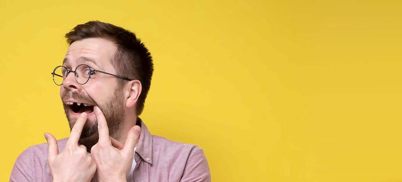 man with missing teeth