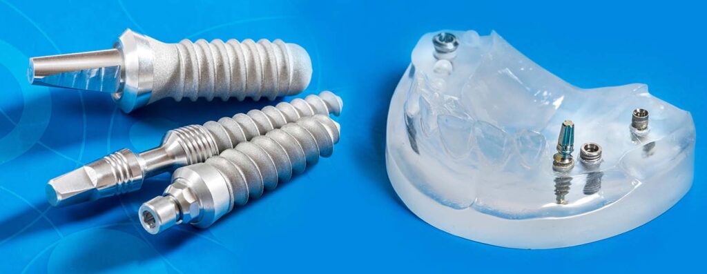 dental implants safty