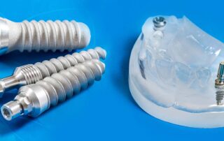 dental implants safty