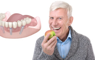 tooth replacement