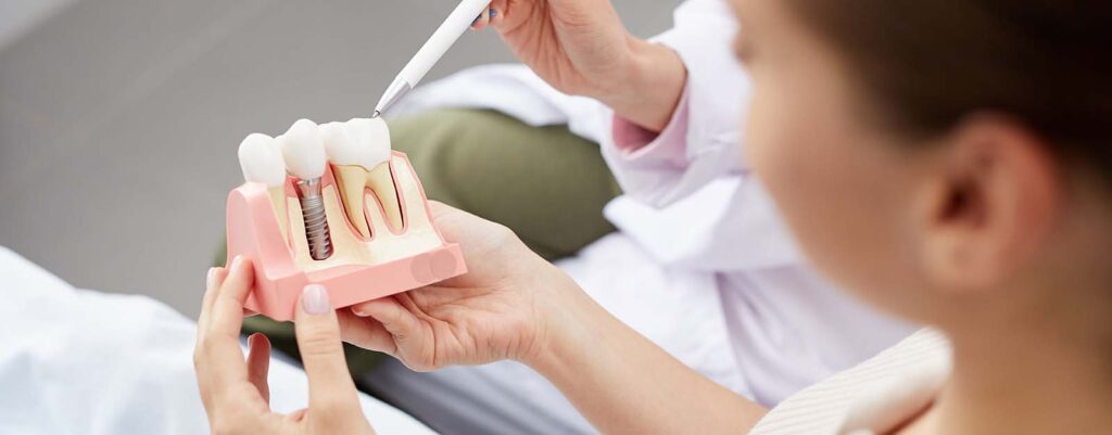 what to eat after dental implants surgery