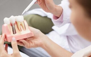 what to eat after dental implants surgery