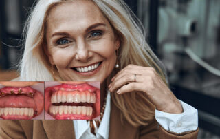 full mouth dental implant usa