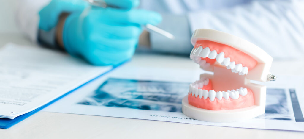 Dentures vs Dental Implants