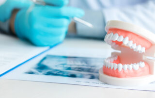 Dentures vs Dental Implants