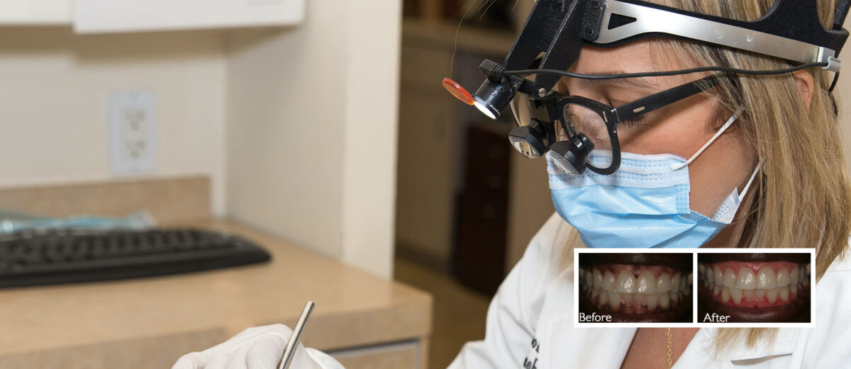 A Complete Guide to Periodontal Pockets & treatment options