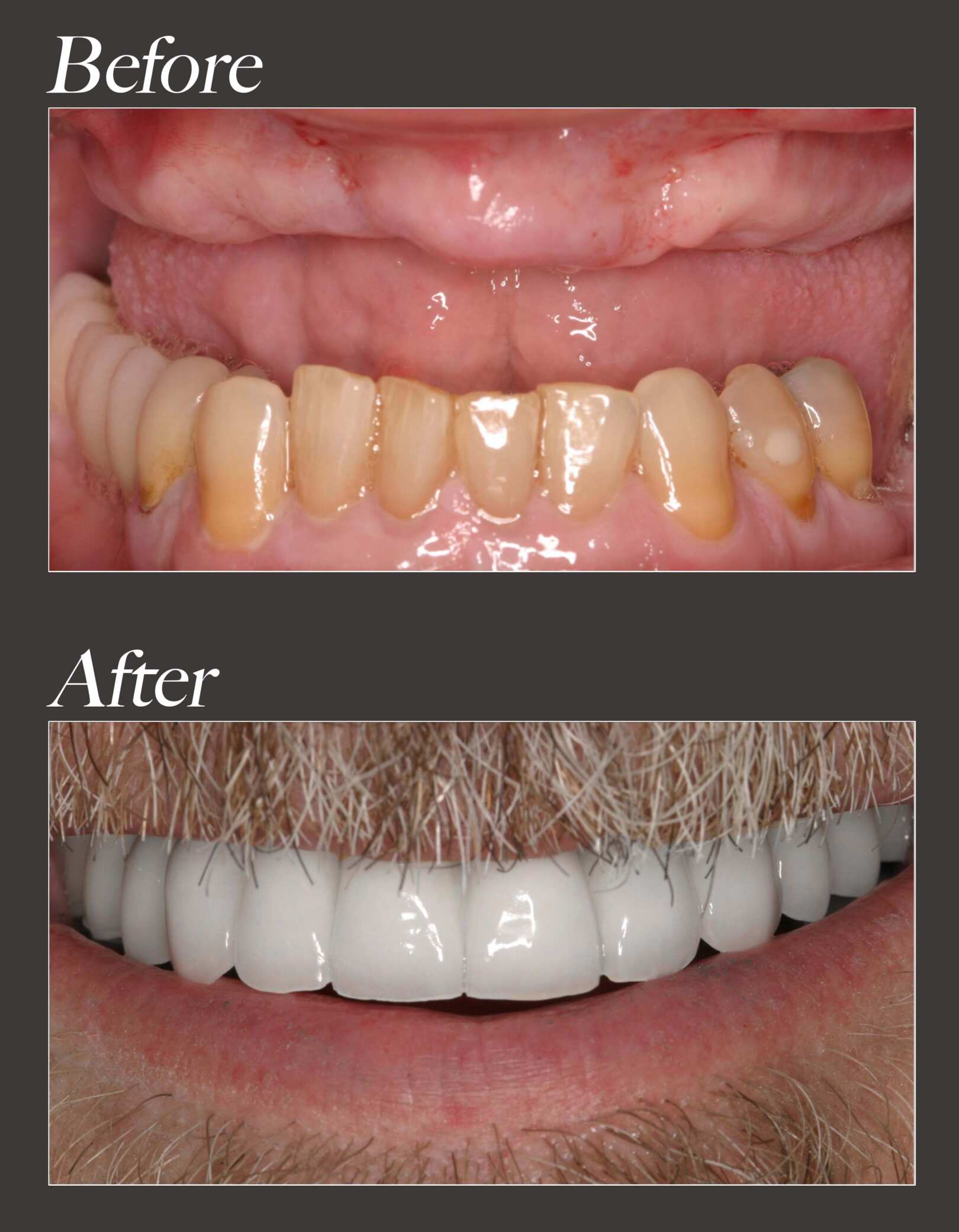 ClearChoice locations vs. Southland Dental Care