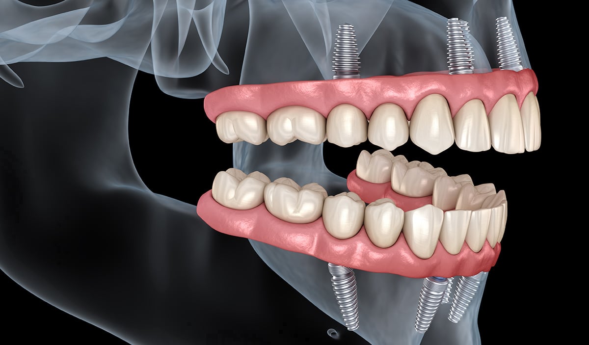 picture of all on 4 system