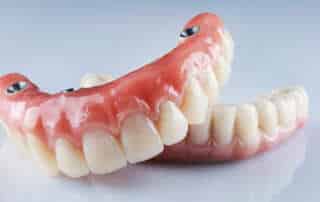Dental Implants Locations in Los Angeles