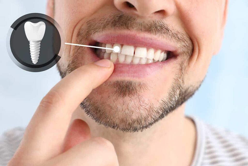 When a Dental Implant Needs a Check-Up or Replacement